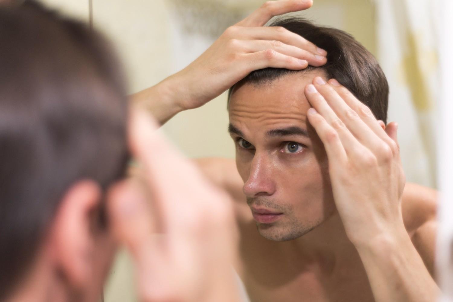 Receding Hairline