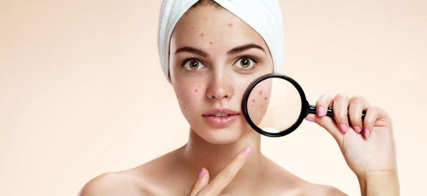 Acne & Acne Scar Treatment treatment view